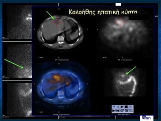Καιμήζεξ επαηηθή θύζηε
 