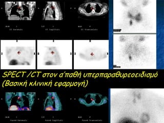 SPECT /CT ζημκ α’παζή οπενπαναζονεμεηδηζμό
(Βαζηθή θιηκηθή εθανμμγή)
 