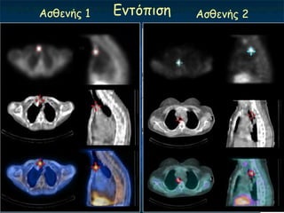 Αζζεκήξ 1   Γκηόπηζε   Αζζεκήξ 2




  ΢θαγή
 