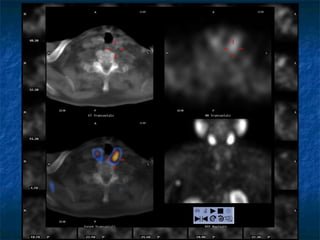 2μ αδέκςμα;




1 αδέκςμα
 