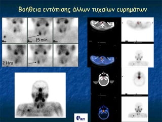 Βμήζεηα εκηόπηζεξ άιιςκ ηοπαίςκ εονεμάηςκ



             15 min




2 Hrs
 