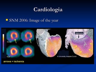 Cardiologia SNM 2006: Image of the year 