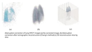 Attenuation correction of lung SPECT images (a) No corrected image, (b) Attenuation
correction after tomographic reconstruction (Chang's method) (c) 3D reconstruction slice by
slice
 