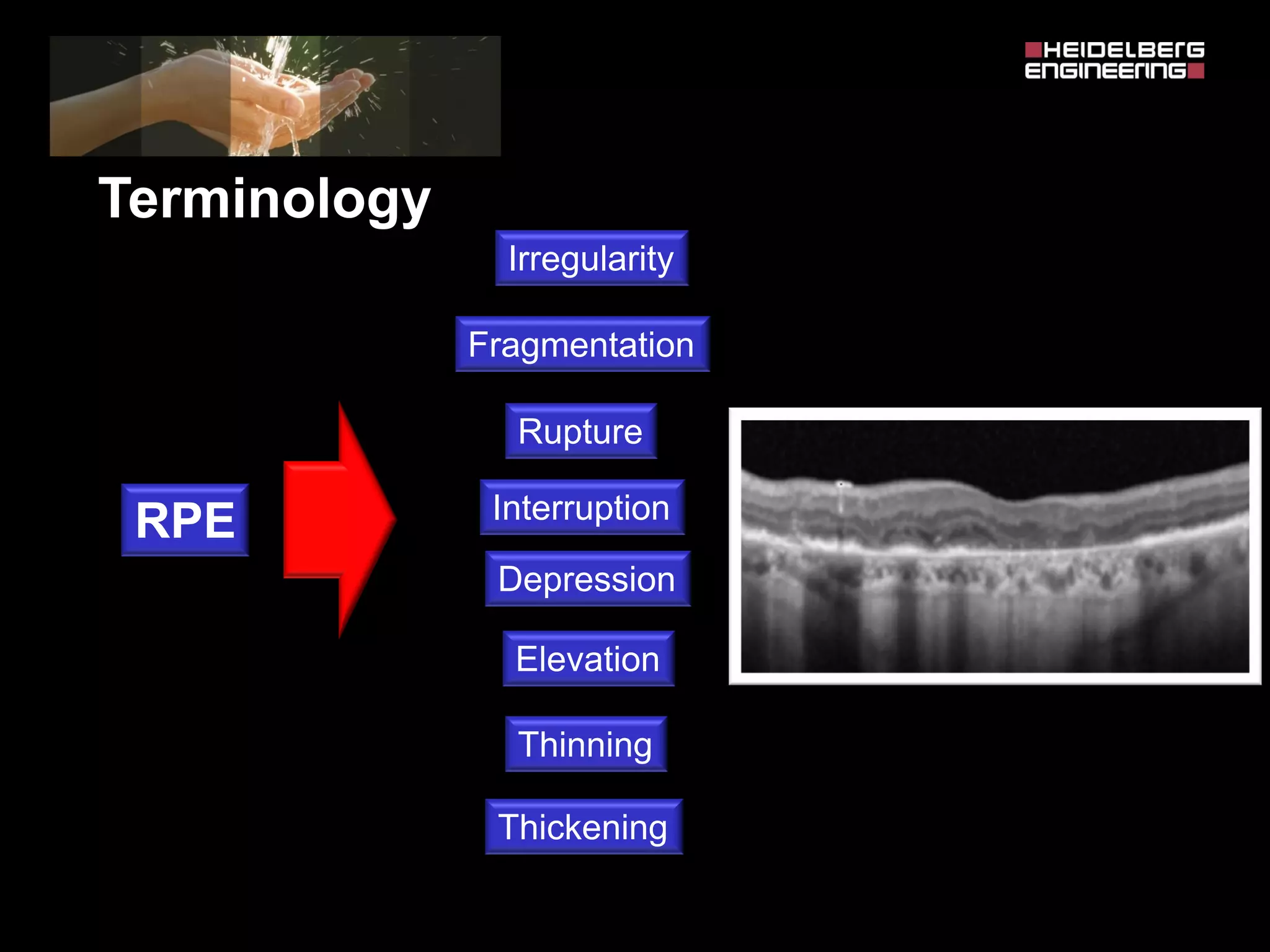 Spectralis oct normal anatomy & systematic interpretation. | PDF
