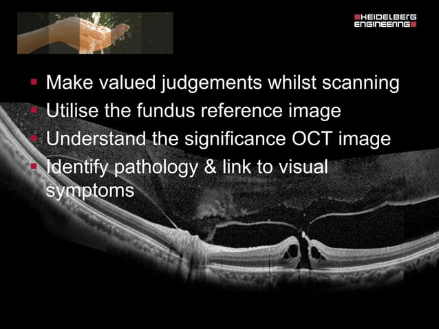 Spectralis oct normal anatomy & systematic interpretation. | PDF | Eye ...