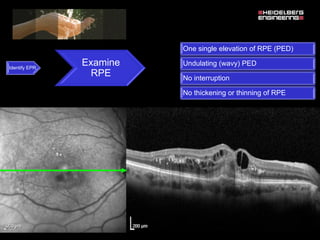 Spectralis oct normal anatomy & systematic interpretation. | PDF