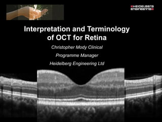 Interpretation and Terminology
of OCT for Retina
Christopher Mody Clinical
Programme Manager
Heidelberg Engineering Ltd
 