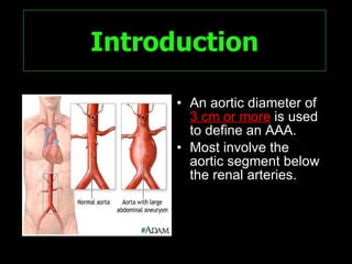 Spectrum Of Ct Findings In Rupture And Impendinging Rupture Of AAA | PPT