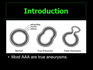 Spectrum Of Ct Findings In Rupture And Impendinging Rupture Of AAA | PPT