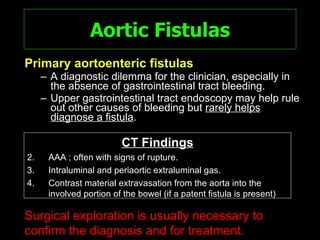 Fistula Rupture Spectrum Of Ct Findings In Rupture And Impendinging Rupture Of AAA | PPT