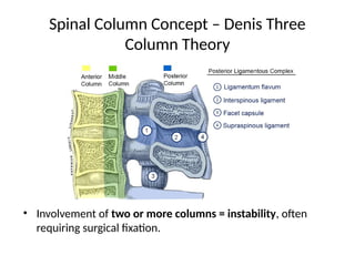 Column Instability Spectrum_of_Spine_Surgery_Devdaha_Medical_College-1.pptx