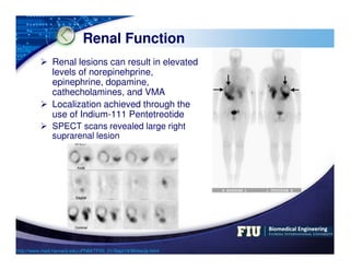LOGO
Renal Function
 Renal lesions can result in elevated
levels of norepinehprine,
epinephrine, dopamine,
cathecholamines...
