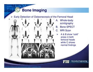 LOGO
Bone Imaging
 Early Detection of Osteonecrosis of the Femoral Head
http://jnm.snmjournals.org/content/43/8/1006/F1.ex...
