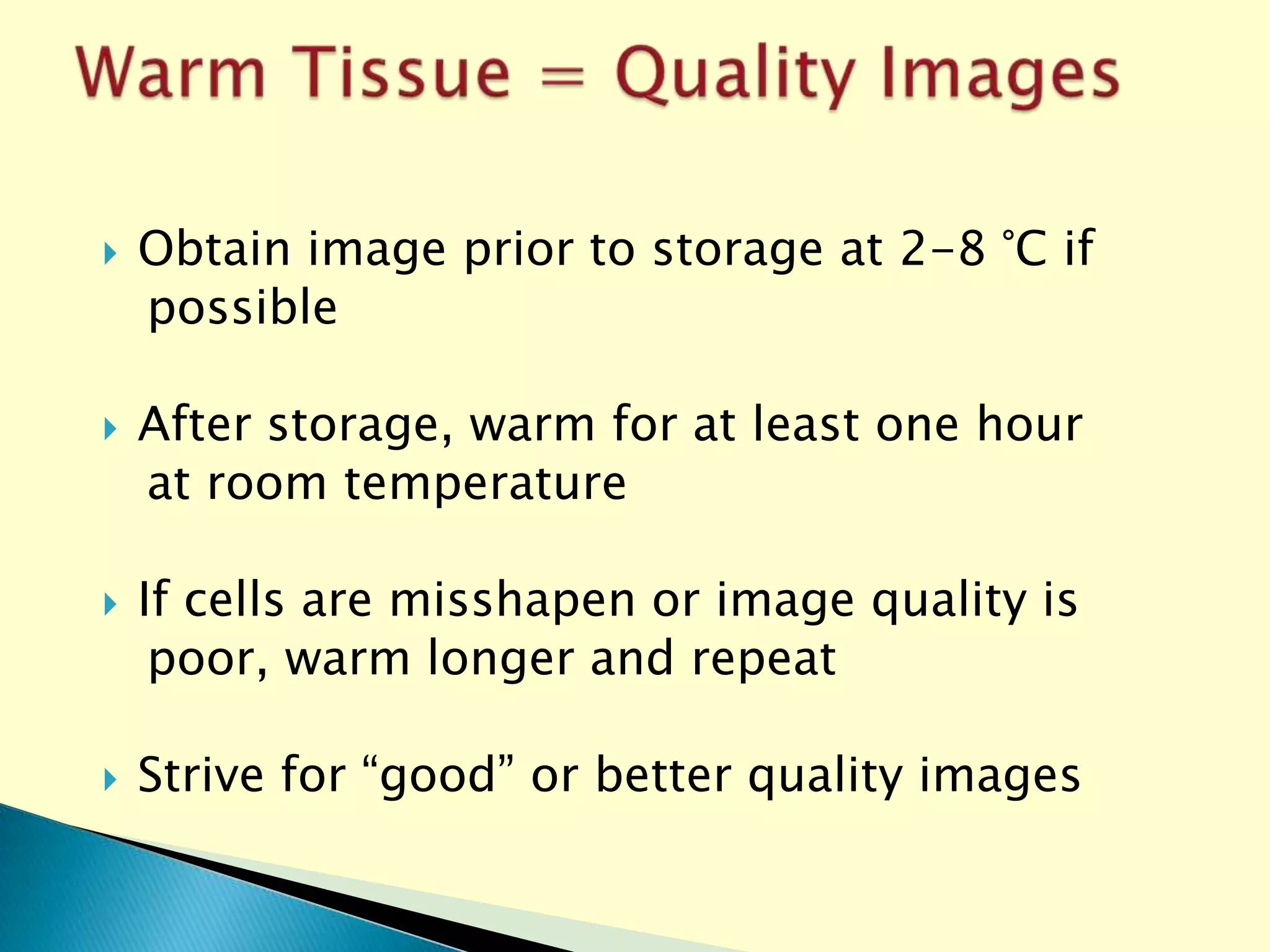 Eye Bank Specular Microscopy PPT