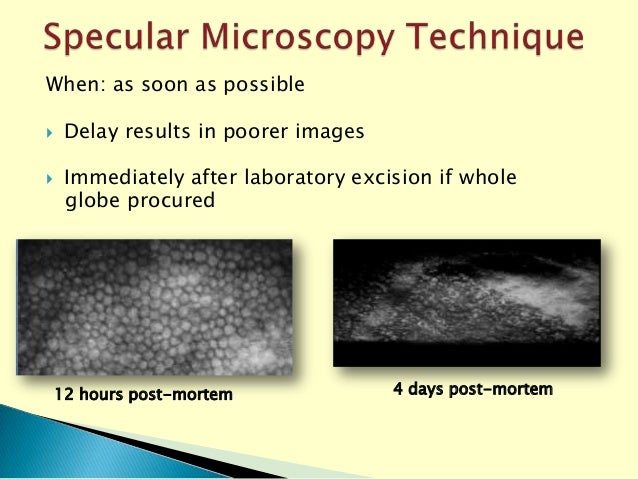 Eye Bank Specular Microscopy
