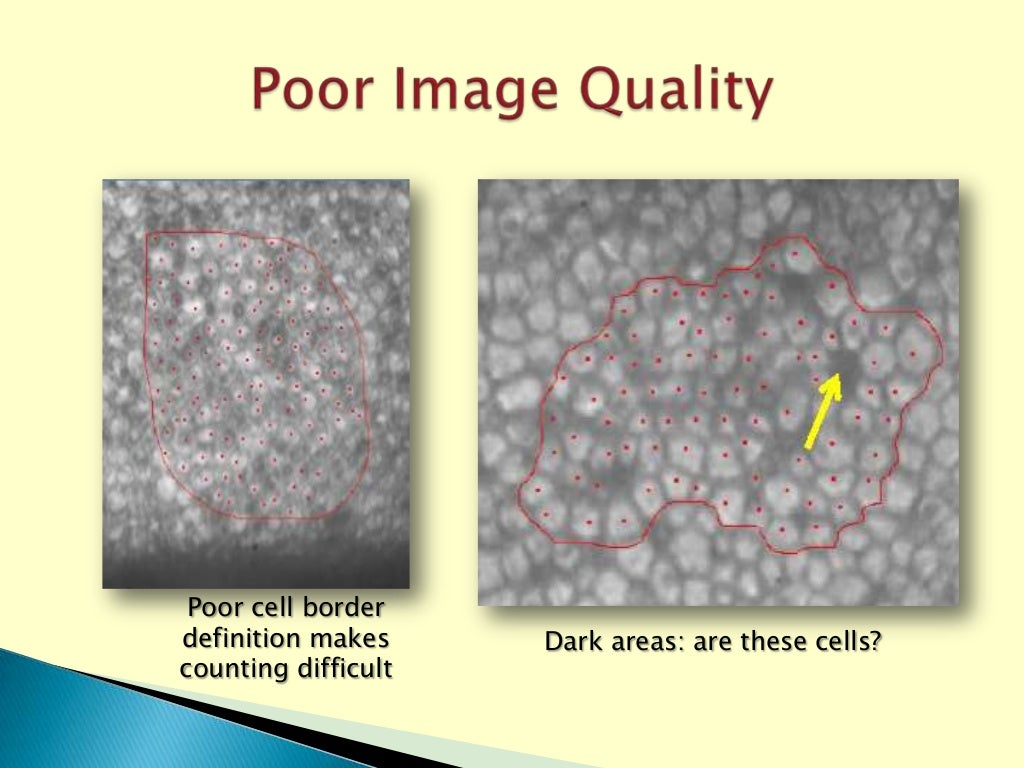 Eye Bank Specular Microscopy