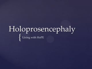 Holoprosencephaly

{

Living with HoPE

 