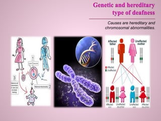 Causes are hereditary and
chromosomal abnormalities.
 