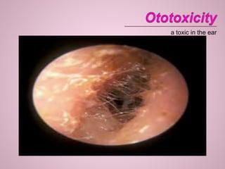 a toxic in the ear
 