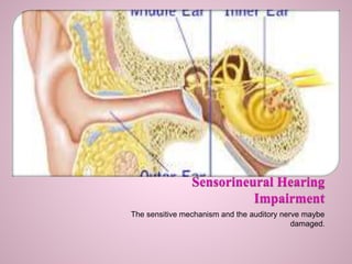The sensitive mechanism and the auditory nerve maybe
damaged.
 