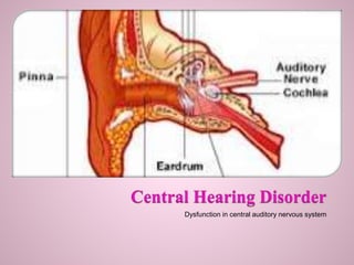 Dysfunction in central auditory nervous system
 