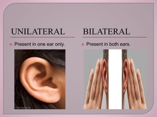 UNILATERAL BILATERAL
 Present in one ear only.  Present in both ears.
 