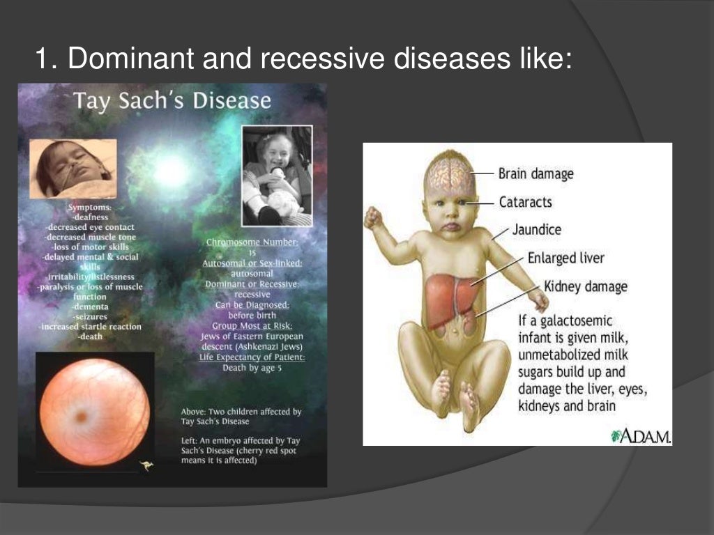 The Biological And Environmental Causes Of Developmental Disabilities