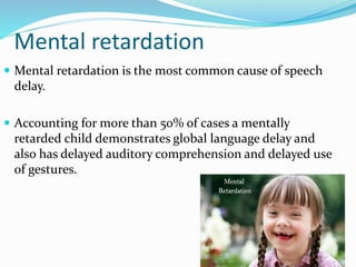 Mental retardation
 Mental retardation is the most common cause of speech
delay.
 Accounting for more than 50% of cases a mentally
retarded child demonstrates global language delay and
also has delayed auditory comprehension and delayed use
of gestures.
 