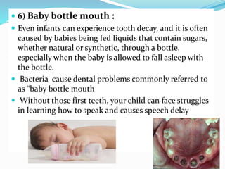  6) Baby bottle mouth :
 Even infants can experience tooth decay, and it is often
caused by babies being fed liquids that contain sugars,
whether natural or synthetic, through a bottle,
especially when the baby is allowed to fall asleep with
the bottle.
 Bacteria cause dental problems commonly referred to
as “baby bottle mouth
 Without those first teeth, your child can face struggles
in learning how to speak and causes speech delay
 