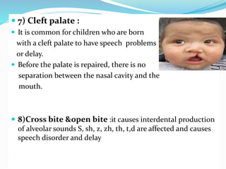  7) Cleft palate :
 It is common for children who are born
with a cleft palate to have speech problems
or delay.
 Before the palate is repaired, there is no
separation between the nasal cavity and the
mouth.
 8)Cross bite &open bite :it causes interdental production
of alveolar sounds S, sh, z, zh, th, t,d are affected and causes
speech disorder and delay
 