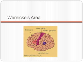 Wernicke’s Area
 