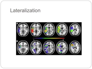 Lateralization
 