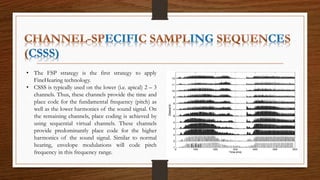 Speech coding strategies in CI | PPTX