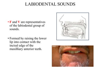 Labiel Sound Speech consideration in complete denture | PPT
