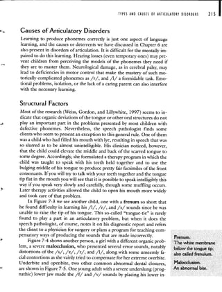 TYPES AND CAUSES OF ARTICULATORY DISORDERS 215
Causes of Articulatory Disorders
Learning to produce phonemes correctly is just one aspect of language
learning, and the causes or deterrents we have discussed in Chapter 6 are
also present in disorders of articulation. It is difficult for the mentally im-
paired to do this learning. Hearing losses (even temporary ones) may pre-
vent children from perceiving the models of the phonemes they need if
they are to master them. Neurological damage, as in cerebral palsy, may
lead to deficiencies in motor control that make the mastery of such mo-
torically complicated phonemes as /r/, and /1/ a formidable task. Emo-
tional problems, isolation, or the lack of a caring parent can also interfere
with the necessary learning.
Structural Factors
Most of the research (Weiss, Gordon, and Lillywhite, 1997) seems to in-
dicate that organic deviations of the tongue or other oral structures do not
play an important part in the problems presented by most children with
defective phonemes. Nevertheless, the speech pathologist finds some
clients who seem to present an exception to this general rule. One of them
was a child who had filled his mouth with lye, resulting in speech that was
so slurred as to be almost unintelligible. His clinician noticed, however,
that the child could elevate the middle and back of the scarred tongue to
some degree. Accordingly, she formulated a therapy program in which the
child was taught to speak with his teeth held together and to use the
bulging middle of his tongue to produce pretty fair facsimiles of the front
consonants. If you will try to talk with your teeth together and the tongue
tip flat in the mouth you will see that it is possible to speak intelligibly this
way if you speak very slowly and carefully, though some muffling occurs.
Later therapy activities allowed the child to open his mouth more widely
and took care of that problem.
In Figure 7-3 we see another child, one with a frenum so short that
he found difficulty in learning his /1/, /r/, and /s/ sounds since he was
unable to raise the tip of his tongue. This so-called "tongue-tie" is rarely
found to play a part in an articulatory problem, but when it does the
speech pathologist, of course, notes it on his diagnostic report and refers
the client to a physician for surgery or plans a program for teaching com-
pensatory ways of producing the sounds that are made incorrectly. Frenum.
Figure 7-4 shows another person, a girl with a different organic prob- The white membrane
lem, a severe malocclusion, who presented several error sounds, notably below the tongue tip;
distortions of the /s/, /z/, /r/, and /1/, along with some unseemly fa- also called frenulum.
cial contortions as she vainly tried to compensate for her extreme overbite.
Underbite and openbite, two other common abnormal dental closures, Malocclusion.
are shown in Figure 7-5. One young adult with a severe underslung (prog- An abnormal bite.
nathic) lower jaw made the /f/ and /v/ sounds by placing his lower in-
 