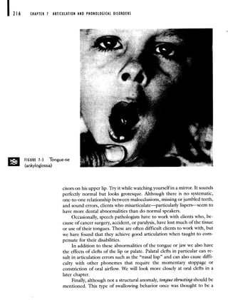CHAPTER 1 ARTICULATION AND PHONOLOGICAL DISORDERS
FIGURE 1-3 Tongue-tie
(ankyloglossia)
cisors on his upper lip. Try it while watching yourself in a mirror. It sounds
perfectly normal but looks grotesque. Although there is no systematic,
one-to-one relationship between malocclusions, missing or jumbled teeth,
and sound errors, clients who misarticulate—particularly lispers—seem to
have more dental abnormalities than do normal speakers.
Occasionally, speech pathologists have to work with clients who, be-
cause of cancer surgery, accident, or paralysis, have lost much of the tissue
or use of their tongues. These are often difficult clients to work with, but
we have found that they achieve good articulation when taught to com-
pensate for their disabilities.
In addition to these abnormalities of the tongue or jaw we also have
the effects of clefts of the lip or palate. Palatal clefts in particular can re-
sult in articulation errors such as the "nasal lisp" and can also cause diffi-
culty with other phonemes that require the momentary stoppage or
constriction of oral airflow. We will look more closely at oral clefts in a
later chapter.
Finally, although not a structural anomaly, tongue thrusting should be
mentioned. This type of swallowing behavior once was thought to be a
 
