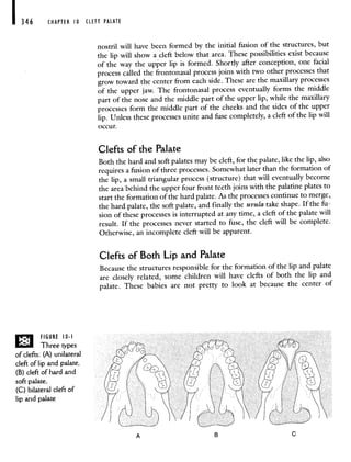 I 346 CHAPTER 10 CLEFT PALATE
nostril will have been formed by the initial fusion of the structures, but
the lip will show a cleft below that area. These possibilities exist because
of the way the upper lip is formed. Shortly after conception, one facial
process called the frontonasal process joins with twoother processes that
grow toward the center from each side. These are the maxillary processes
of the upper jaw. The frontonasal process eventually forms the middle
part of the nose and the middle part of the upper lip, while the maxillary
processes form the middle part of the cheeks and the sides of the upper
lip. Unless these processes unite and fuse completely, a cleft of the lipwill
occur.
Clefts of the Palate
Both the hard and soft palates may be cleft, for the palate, like the lip, also
requires a fusion of three processes. Somewhat later than the formationof
the lip, a small triangular process (structure) that will eventually become
the area behind the upper four front teeth joins with the palatine plates to
start the formation of the hard palate. As the processes continue to merge,
the hard palate, the soft palate, and finally the uvula take shape. If the fu-
sion of these processes is interrupted at any time, a cleft of the palate will
result. If the processes never started to fuse, the cleft will be complete.
Otherwise, an incomplete cleft will be apparent.
Clefts of Both Lip and Palate
Because the structures responsible for the formation of the lip and palate
are closely related, some children will have clefts of both the lip and
palate. These babies are not pretty to look at because the center of
FIGURE 10.1
Three types
of clefts: (A) unilateral
cleft of lip and palate,
(B) cleft of hard and
soft palate,
(C) bilateral cleft of
lip and palate
A B C
 