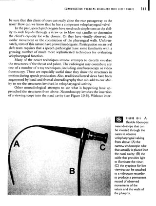 COMMUNICATION PROBLEMS ASSOCIATED WITH CLEFT PALATE 363
be sure that this client of ours can really close the rear passageway to the
nose? How can we know that he has a competent velopharyngeal valve?
In the past, speech pathologists have used such simple tests as the abil-
ity to suck liquids through a straw or to blow out candles to determine
the client's capacity for velar closure. Or they have visually observed the
uvular movement or the constriction of the pharyngeal walls. Unfortu-
nately, tests of this nature have proved inadequate. Participation on an oral
cleft team requires that a speech pathologist have some familiarity with a
growing number of much more sophisticated techniques for evaluating
velopharyngeal function.
Many of the newer techniques involve attempts to directly visualize
the structures of the throat and palate. The radiologist may contribute any
one of a number of x-ray techniques, including cinefluoroscopy or video
fluoroscopy. These are especially useful since they show the structures in
motion during speech production. Also, traditional lateral views have been
augmented by basal and frontal cineradiography that can add to our abil-
ity to see the structures involved in velopharyngeal activity.
Other nonradiological attempts to see what is happening have ap-
proached the structures from above. Nasendoscopy involves the insertion
of a viewing scope into the nasal cavity (see Figure 10-5). Without inter-
- ---- —
FIGURE 10.5 A
flexible fiberoptic
nasendoscope that can
be inserted through the
nares to observe
velopharyngeal valving
from above: (A) the
narrow endoscopic tube
that actually is placed into
the nasal cavity; (B) the
cable that provides light
to illuminate the view;
(C) the eyepiece for live
viewing can be attached
to a videotape recorder
to produce a permanent
record of observed
movements of the
velum and the walls of
the pharynx.
 