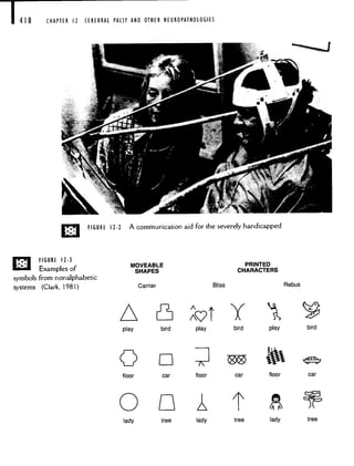 1418 CHAPTER 12 CEREBRAL PALSY AND OTHER NEUROPATHOLOGIES
D FIGURE 12-3
Examples of
symbols from nonalphabetic
systems (Clark, 1981)
n
car floor car floor car
lady tree lady tree lady tree
D FIGURE 12-2 A communication aid for the severely handicapped
MOVEABLE
SHAPES
Carrier Bliss
PRINTED
CHARACTERS
Rebus
bird
c71
play
Y
bird play
A
play
C
floor
0
bird
LI
 