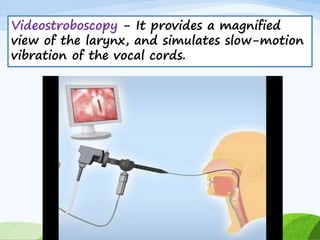 Videostroboscopy - It provides a magnified
view of the larynx, and simulates slow-motion
vibration of the vocal cords.
 