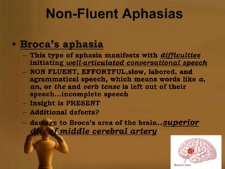Non-Fluent Aphasias

• Broca’s aphasia
  – This type of aphasia manifests with difficulties
    initiating well-articulated conversational speech
  – NON FLUENT, EFFORTFUL,slow, labored, and
    agrammatical speech, which means words like a,
    an, or the and verb tense is left out of their
    speech…incomplete speech
  – Insight is PRESENT
  – Additional defects?
  – damage to Broca’s area of the brain..superior
   div. of middle cerebral artery


                                                  Page 12
 