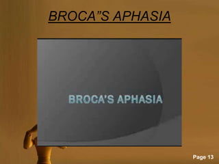BROCA”S APHASIA




                  Page 13
 
