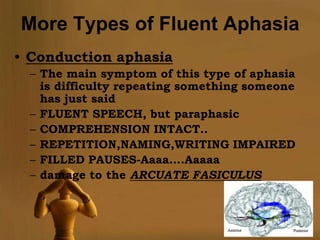 More Types of Fluent Aphasia
• Conduction aphasia
  – The main symptom of this type of aphasia
    is difficulty repeating something someone
    has just said
  – FLUENT SPEECH, but paraphasic
  – COMPREHENSION INTACT..
  – REPETITION,NAMING,WRITING IMPAIRED
  – FILLED PAUSES-Aaaa….Aaaaa
  – damage to the ARCUATE FASICULUS



                                          Page 9
 