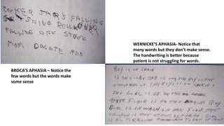 BROCA’S APHASIA – Notice the
few words but the words make
some sense
WERNICKE’S APHASIA- Notice that
many words but they don’t make sense.
The handwriting is better because
patient is not struggling for words.
 