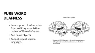 PURE WORD
DEAFNESS
:
• Interruption of information
from auditory association
cortex to Wernicke’s area.
• Can name objects
• Cannot repeat spoken
language.
 