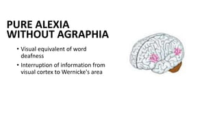 PURE ALEXIA
WITHOUT AGRAPHIA
• Visual equivalent of word
deafness
• Interruption of information from
visual cortex to Wernicke's area
 