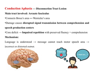Speech Disorders aphasia and brain lesions | PPTX
