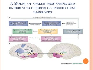 A MODEL OF SPEECH PROCESSING AND
UNDERLYING DEFICITS IN SPEECH SOUND
DISORDERS
 