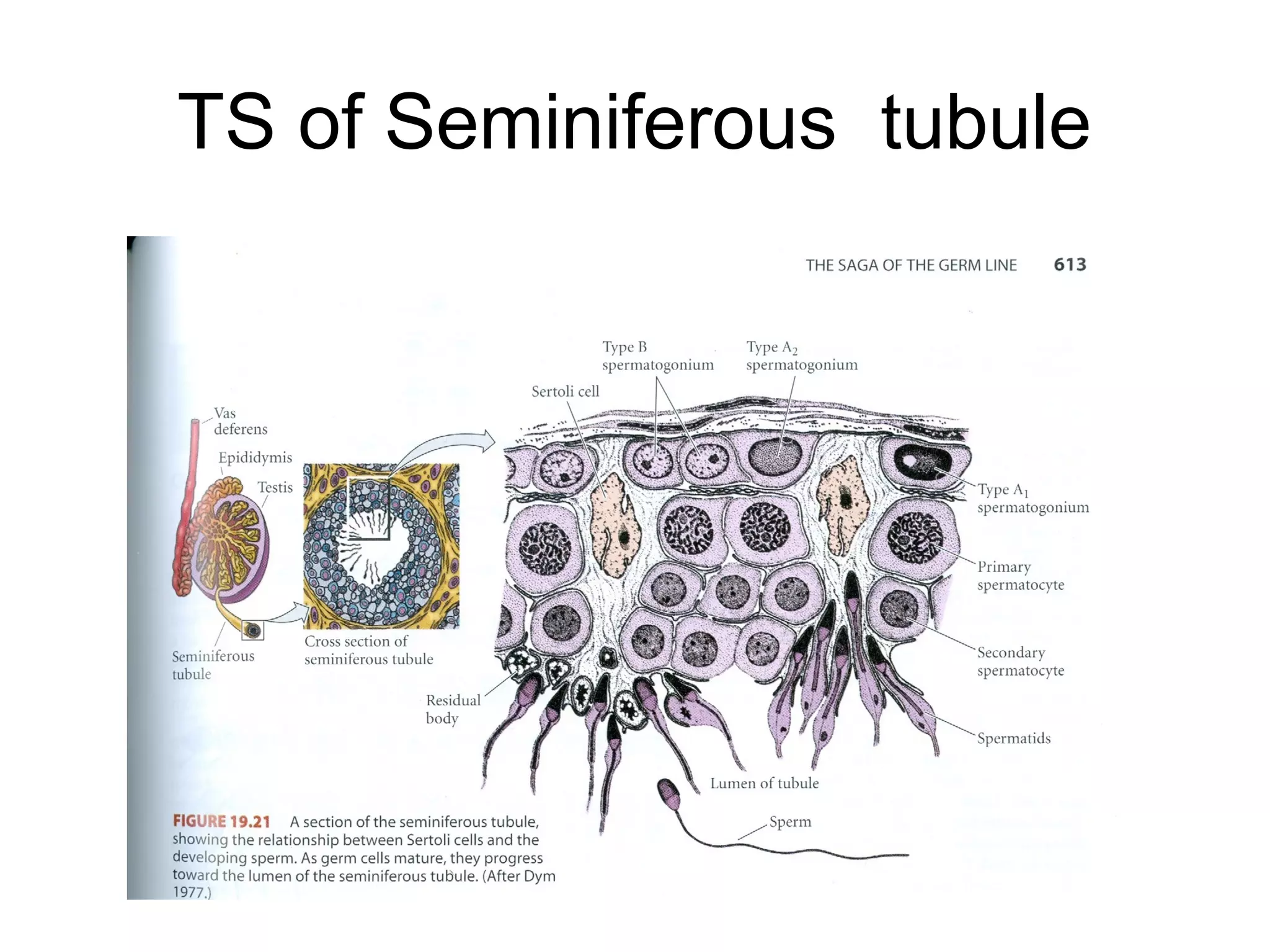 TS of Seminiferous tubule
 