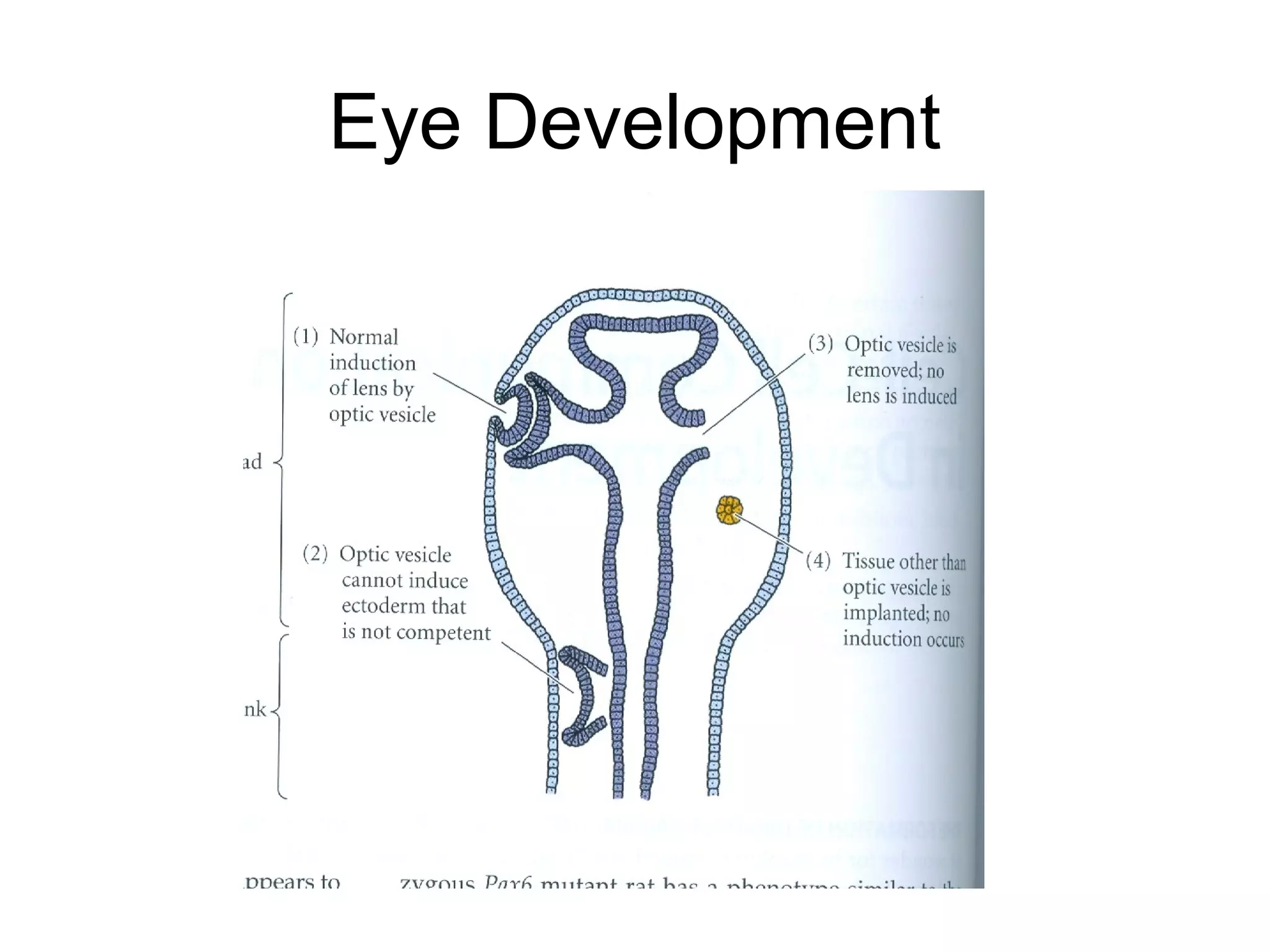 Eye Development
 